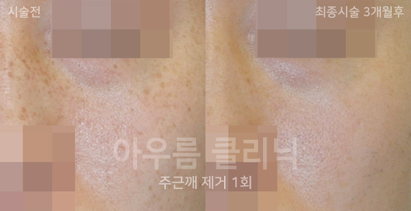 원문 이미지 1