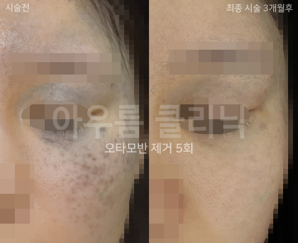 원문 이미지 1
