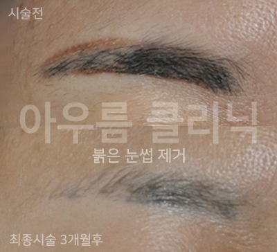 원문 이미지 1