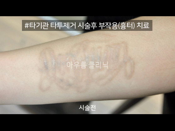 원문 이미지 3