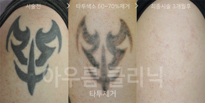 원문 이미지 1