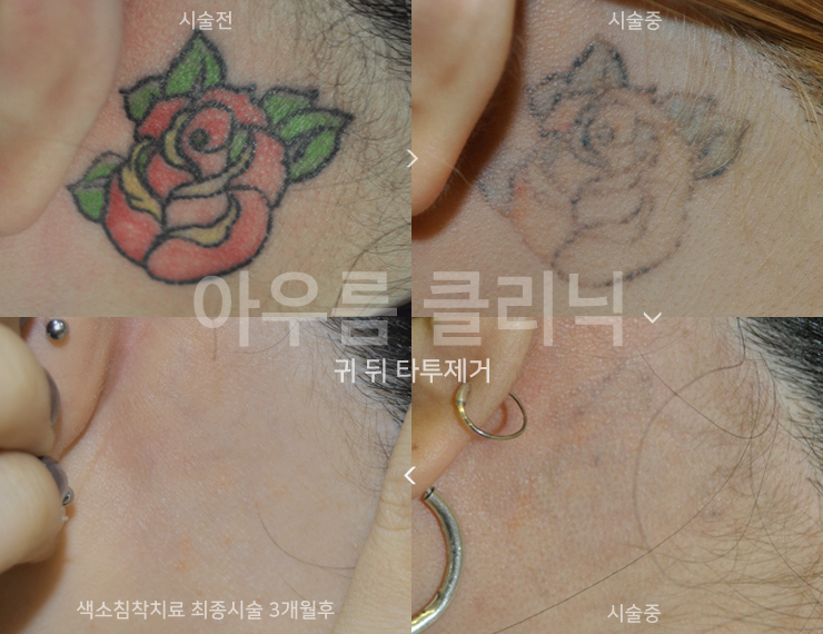 원문 이미지 1
