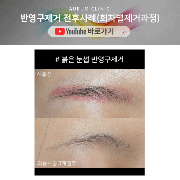 원문 이미지 2