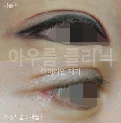 원문 이미지 1
