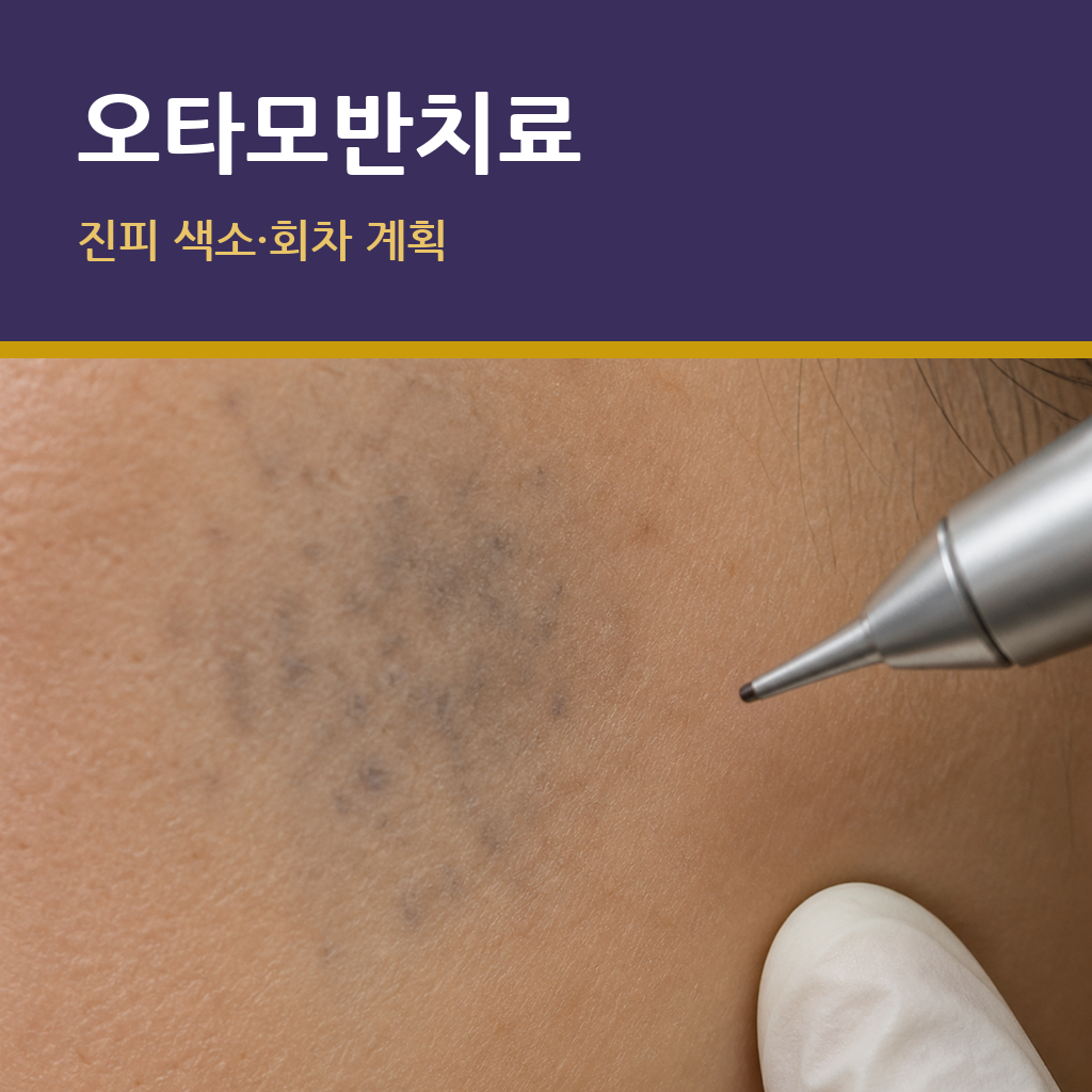 오타모반치료에서 색소 깊이와 파장 반응이 중요한 이유