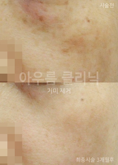 장비 화면
