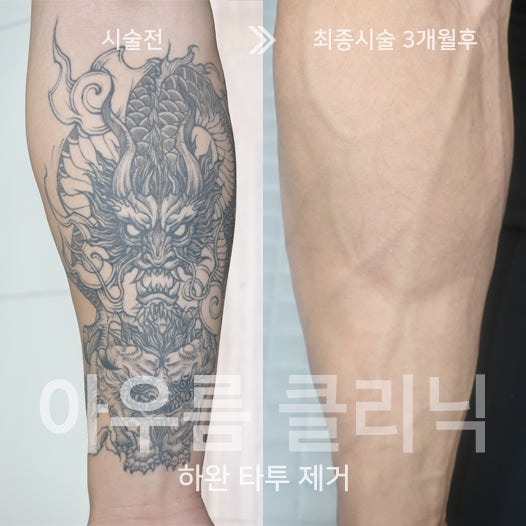 통증관리