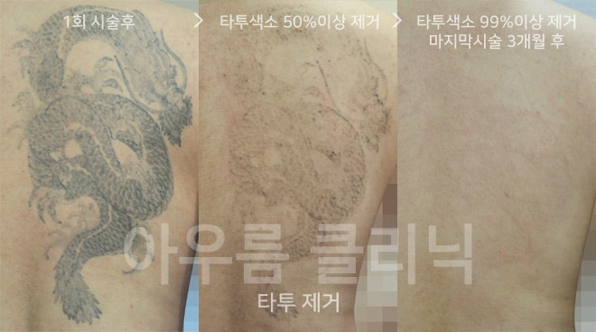관리 안내