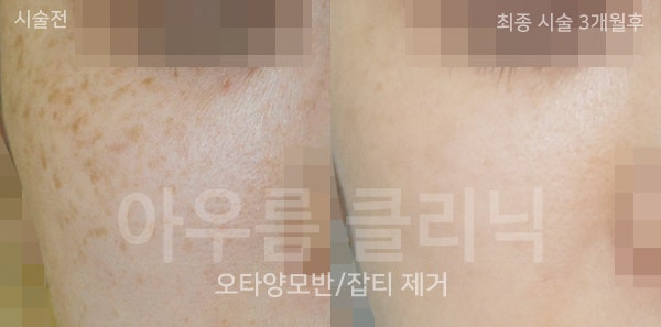 색상차이
