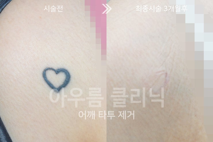원문 이미지 3