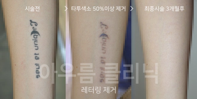 원문 이미지 2