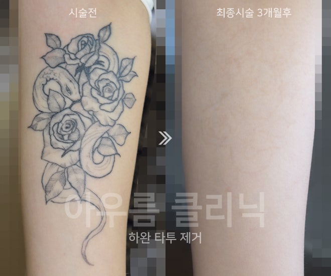 간격계획