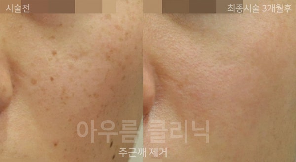 부위 확인