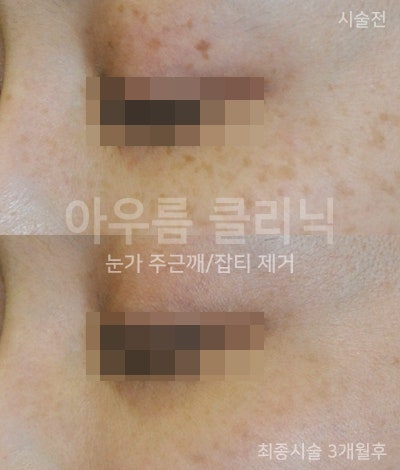 피부 상태