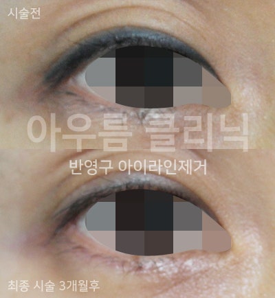 원문 이미지 5