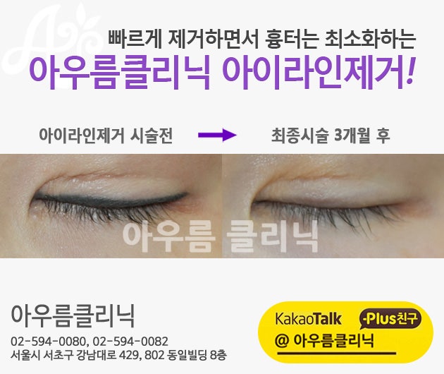 장비 구성