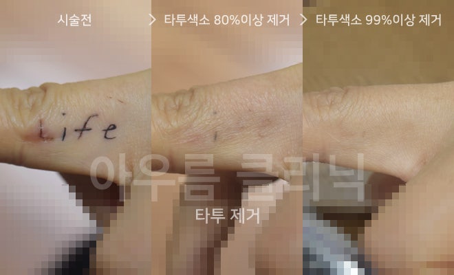 목주름이 생기는 원인과 관리법, 아우름의원에서 살펴보기 — 아우름의원