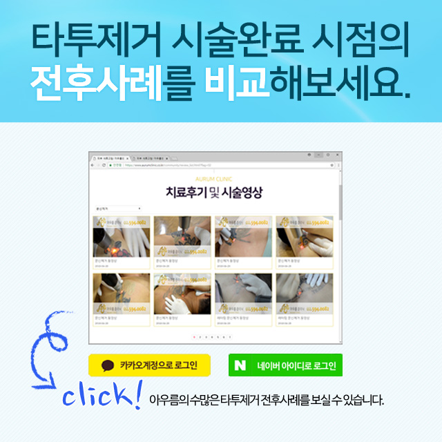 보습 관리