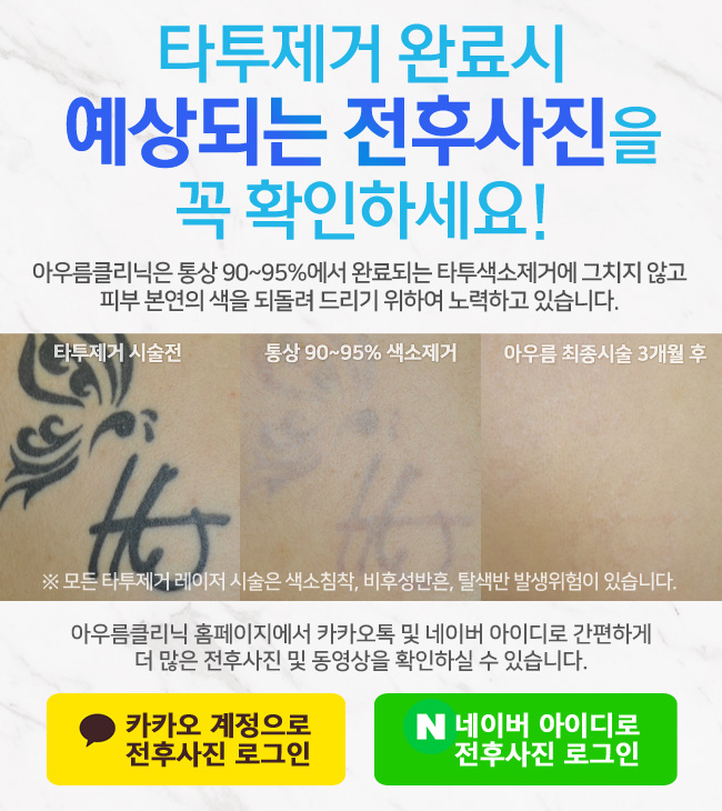 회복 경과