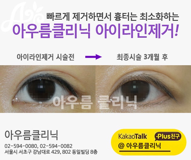 관리 안내