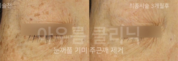 조사 범위