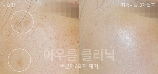 진료상담