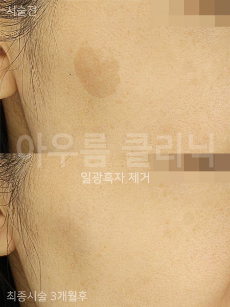 증상비교