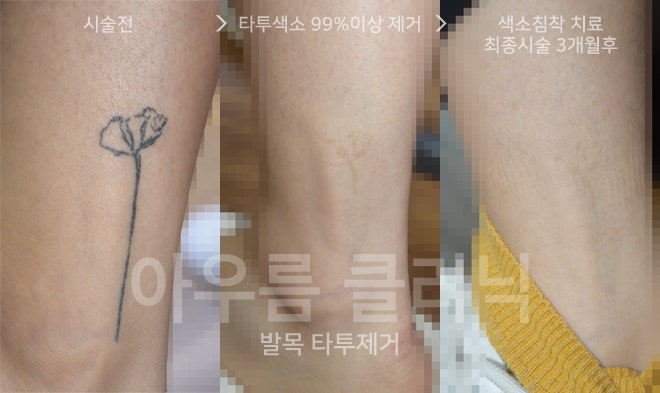원문 이미지 10