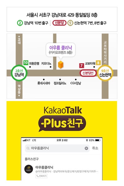 레이저 조사