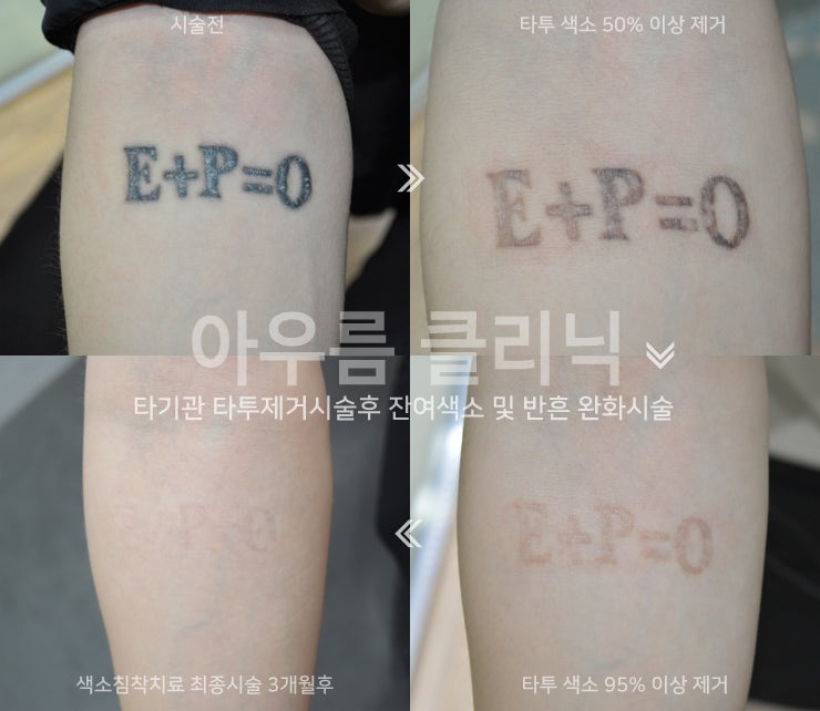 피부 관찰