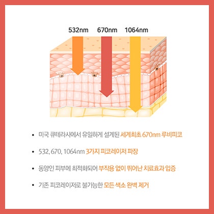 장비 구성