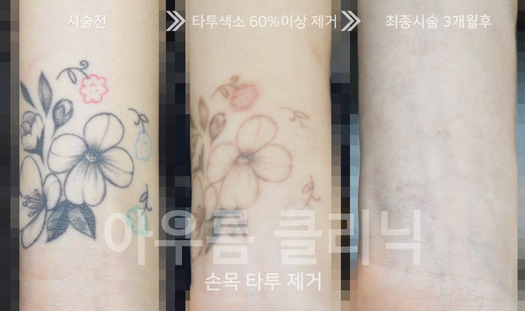 원문 이미지 14