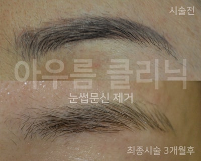 조사 범위