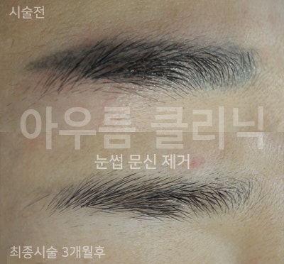 경과관찰