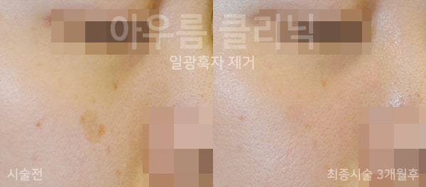 조사 범위
