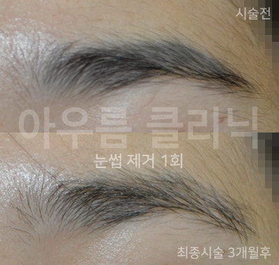 진행경과