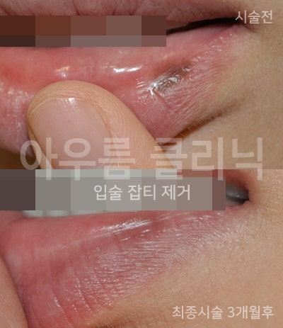 진료 상담