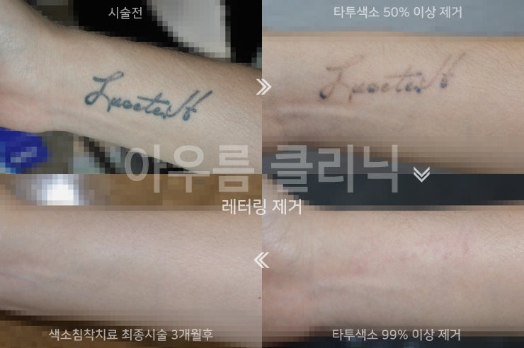 상담메모