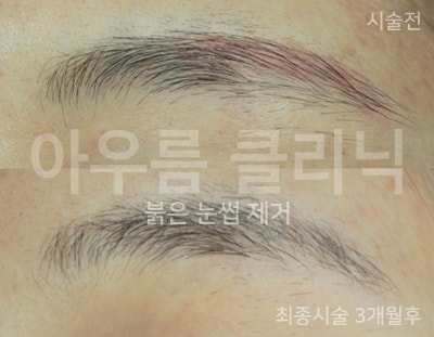 자외선차단