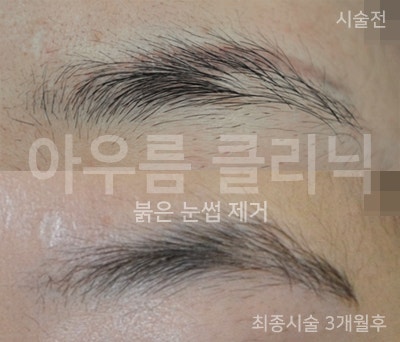 간격계획