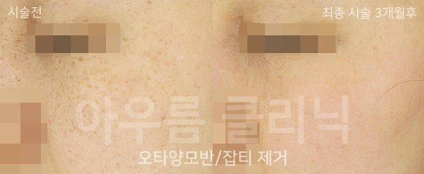 치료 계획