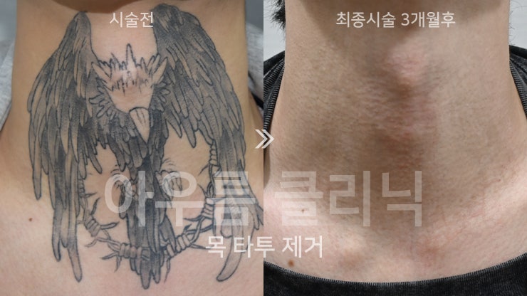 통증관리