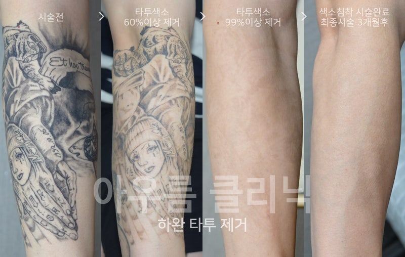 회복단계