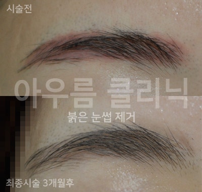 치료 계획