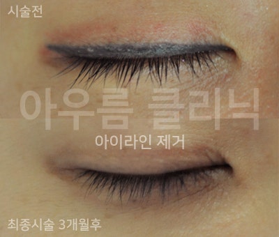 장비 화면