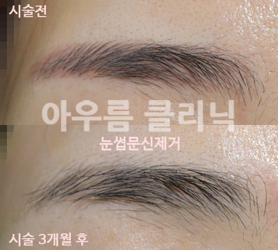 시술 장면