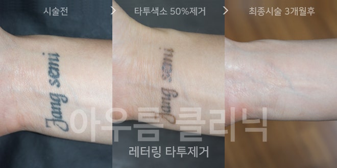 원문 이미지 11