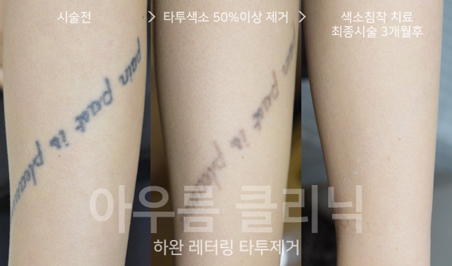 원문 이미지 12