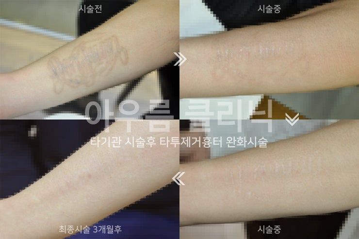 치료 계획