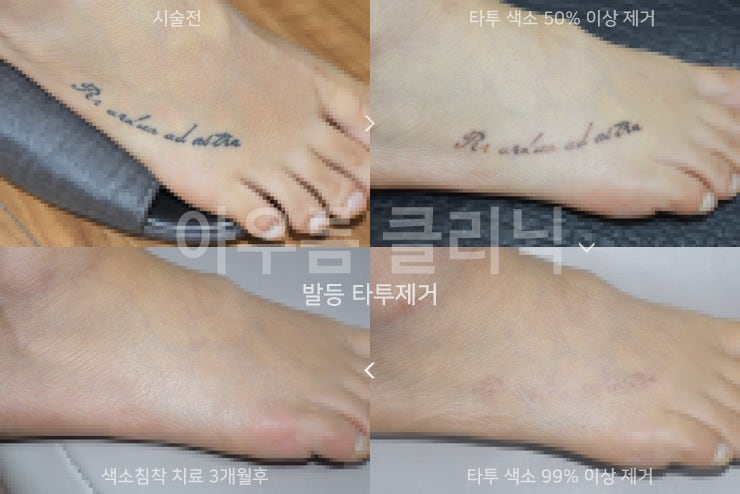 피부 상태